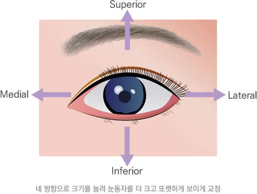 4방향 눈 크기 확대 (4 Directional Enlargement)