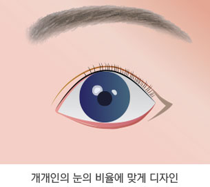 뒷트임 수술방법 1단계