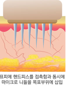 治疗原理 第1步